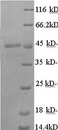 Recombinant Pig Transcobalamin-1 (TCN1) – Figure 1 of 1