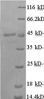 Recombinant Pig Transcobalamin-1 (TCN1) – Figure 1 of 1