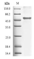 Recombinant Human Tryptophan 2,3-dioxygenase (TDO2) – Figure 1 of 1