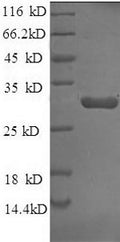 Recombinant Rabbit Tissue factor pathway inhibitor (TFPI) – Figure 1 of 1