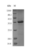 Recombinant Sheep Protransforming growth factor alpha (TGFA), partial – Figure 1 of 1