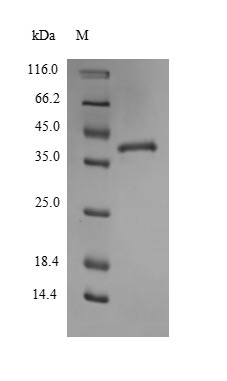 Recombinant Mouse Thrombospondin-1 (Thbs1), partial – Figure 1 of 1