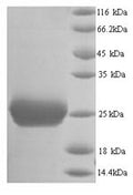Recombinant Mouse Thrombospondin-2 (Thbs2), partial – Figure 1 of 1