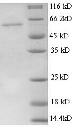 Recombinant Mouse Thrombospondin-3 (Thbs3), partial – Figure 1 of 1