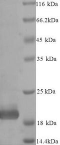 Recombinant Bovine Metalloproteinase inhibitor 4 (TIMP4) – Figure 1 of 1