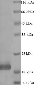 Recombinant Bovine Metalloproteinase inhibitor 4 (TIMP4) – Figure 1 of 1