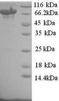 Recombinant Human Toll-like receptor 8 (TLR8), partial – Figure 1 of 1