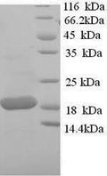 Recombinant Sheep Tumor necrosis factor (TNF), partial – Figure 1 of 1