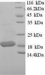 Recombinant Sheep Tumor necrosis factor (TNF), partial – Figure 1 of 1