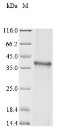 (Tris-Glycine gel) Discontinuous SDS-PAGE (reduced) with 5% enrichment gel and 15% separation gel.