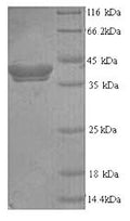 Recombinant Human Thyroid peroxidase (TPO), partial – Figure 1 of 1