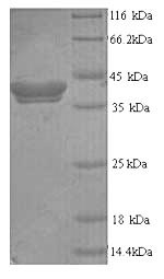 Recombinant Human Thyroid peroxidase (TPO), partial – Figure 1 of 1