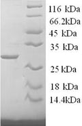 Recombinant Mouse Tryptase (Tpsab1), partial – Figure 1 of 1
