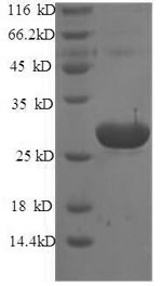 Recombinant Mouse Translationally-controlled tumor protein (Tpt1) – Figure 1 of 1