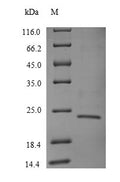 Recombinant Human T cell receptor beta constant 1 (TRBC1), partial – Figure 1 of 1