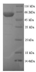 Recombinant Human E3 ubiquitin-protein ligase TRIM21 (TRIM21) – Figure 1 of 1