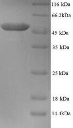 Recombinant Human Tubulin beta-2A chain (TUBB2A) – Figure 1 of 1
