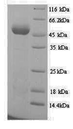 Recombinant Acinetobacter baumannii Elongation factor Tu (tuf1) – Figure 1 of 1
