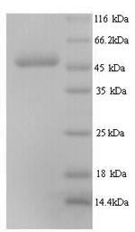 Recombinant Human Elongation factor Tu, mitochondrial (TUFM) – Figure 1 of 1
