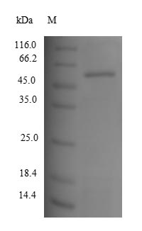 Recombinant Human Tyrosinase (TYR), partial – Figure 1 of 1