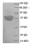Recombinant Human Mitochondrial brown fat uncoupling protein 1 (UCP1) – Figure 1 of 1