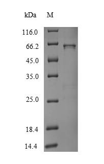 Recombinant Human UDP-glucuronosyltransferase 1A1 (UGT1A1) – Figure 1 of 1