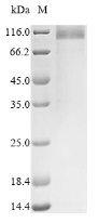 Recombinant Mouse Uromodulin (Umod), partial – Figure 1 of 1