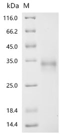 (Tris-Glycine gel) Discontinuous SDS-PAGE (reduced) with 5% enrichment gel and 15% separation gel.