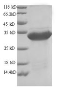 Recombinant Arthrobacter globiformis Uricase (uox), partial – Figure 1 of 1