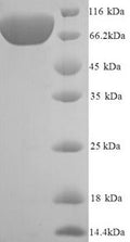 Recombinant Human Vascular cell adhesion protein 1 (VCAM1), partial – Figure 1 of 1
