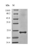 Recombinant Human Vascular endothelial growth factor B (VEGFB) – Figure 1 of 1