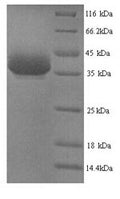 Recombinant Mouse Y-box-binding protein 1 (Ybx1) – Figure 1 of 1