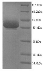 Recombinant Mouse Y-box-binding protein 1 (Ybx1) – Figure 1 of 1