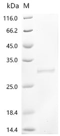 (Tris-Glycine gel) Discontinuous SDS-PAGE (reduced) with 5% enrichment gel and 15% separation gel.