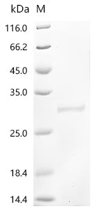 (Tris-Glycine gel) Discontinuous SDS-PAGE (reduced) with 5% enrichment gel and 15% separation gel.
