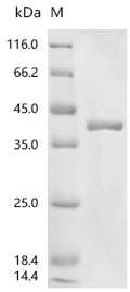 (Tris-Glycine gel) Discontinuous SDS-PAGE (reduced) with 5% enrichment gel and 15% separation gel.