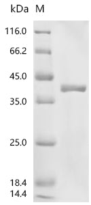 (Tris-Glycine gel) Discontinuous SDS-PAGE (reduced) with 5% enrichment gel and 15% separation gel.