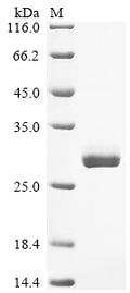 (Tris-Glycine gel) Discontinuous SDS-PAGE (reduced) with 5% enrichment gel and 15% separation gel.
