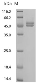 (Tris-Glycine gel) Discontinuous SDS-PAGE (reduced) with 5% enrichment gel and 15% separation gel.