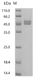 (Tris-Glycine gel) Discontinuous SDS-PAGE (reduced) with 5% enrichment gel and 15% separation gel.
