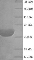 Recombinant Rat Type II iodothyronine deiodinase (Dio2) – Figure 1 of 1