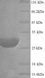 Recombinant Rat Type II iodothyronine deiodinase (Dio2) – Figure 1 of 1