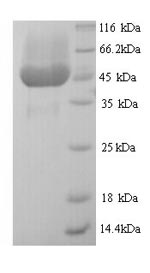 Recombinant Enterobacteria phage M13 Attachment protein G3P (III) – Figure 1 of 1