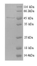 Recombinant Escherichia coli Ribonucleoside-diphosphate reductase 1 subunit beta (nrdB) – Figure 1 of 1