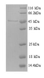 Recombinant Escherichia coli Ribonucleoside-diphosphate reductase 1 subunit beta (nrdB) – Figure 1 of 1