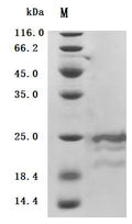 (Tris-Glycine gel) Discontinuous SDS-PAGE (reduced) with 5% enrichment gel and 15% separation gel.