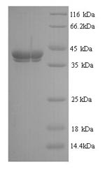 (Tris-Glycine gel) Discontinuous SDS-PAGE (reduced) with 5% enrichment gel and 15% separation gel.