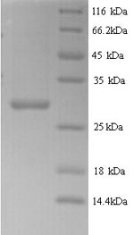 Recombinant Arabidopsis thaliana Putative defensin-like protein 70 (LCR83) – Figure 1 of 1