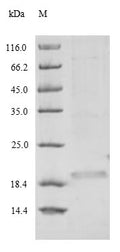 Recombinant Bauhinia ungulata Factor Xa inhibitor BuXI (BuXI) – Figure 1 of 1