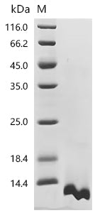 (Tris-Glycine gel) Discontinuous SDS-PAGE (reduced) with 5% enrichment gel and 15% separation gel.
